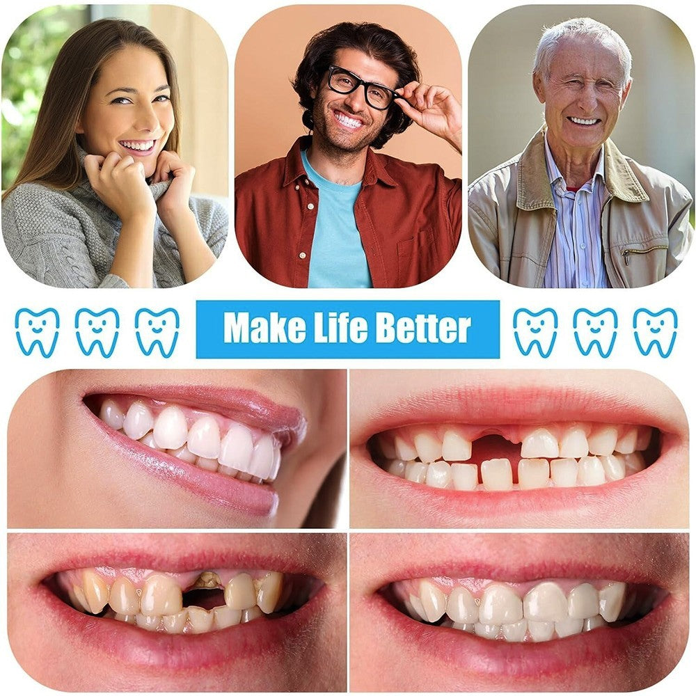 DIY Denture Fake Teeth-Full/Partial Denture at Home Repair Missing Teeth Set UK-