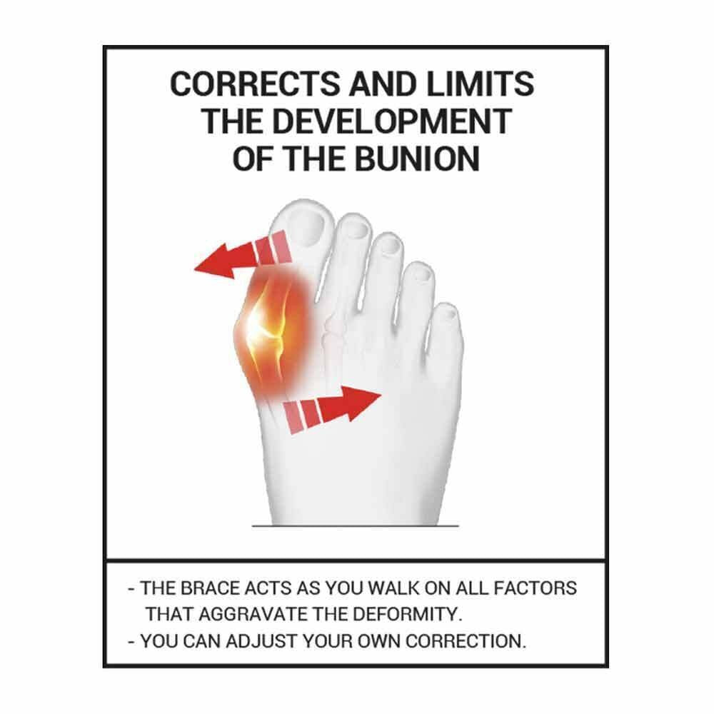 Flexible Daytime Bunion Corrector Hallux Valgus Bunion Foot Care Tool UK