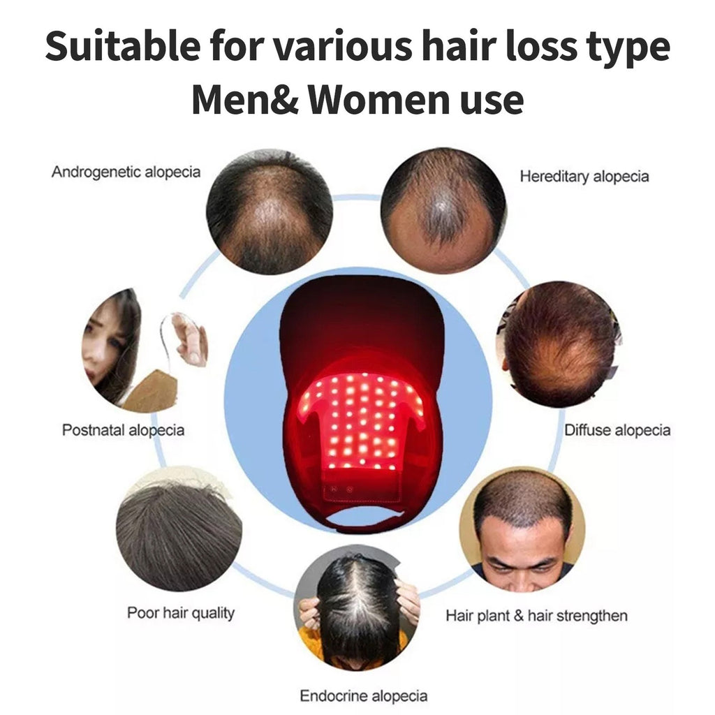 LED Red Light Therapy Hair Growth Cap Fast Regrowth Anti-Hair Loss Hat UK