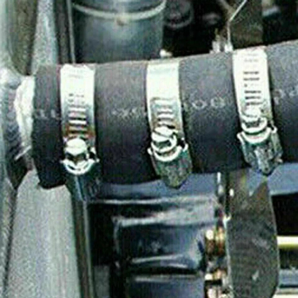 101x Assorted Stainless Steel Hose Clamp Kit With No Driver Jubilee Clips Set UK