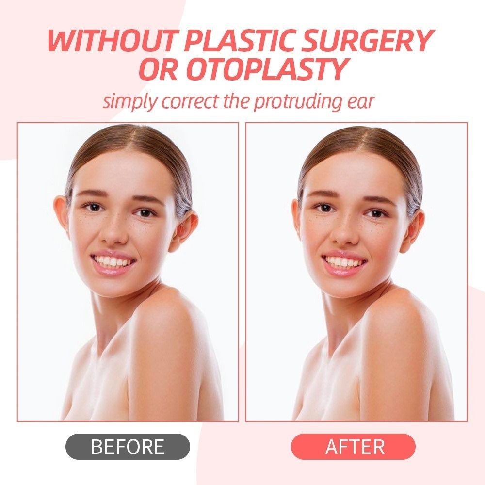 Silicone Ear Correctors Adhesive Ear Corrector for Adults Men Women All Ages