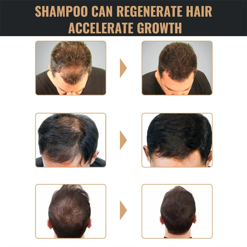 Spartan Shampoo, Spartan Root Activator Shampoo, Mane Root Activator for Hair~