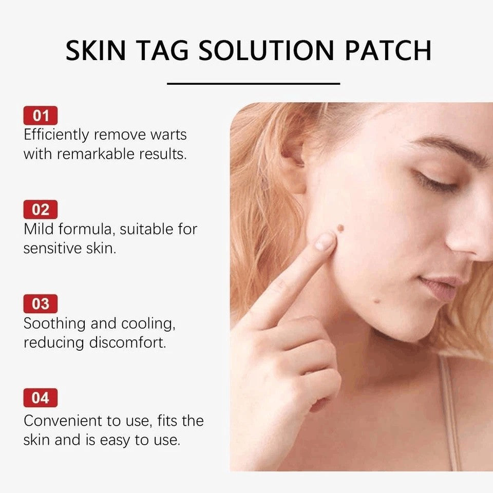 BOX MICRONEEDLE BOTANIC Skin Tag & Acne Patch 9 Pcs Skin Tag Remover Patches