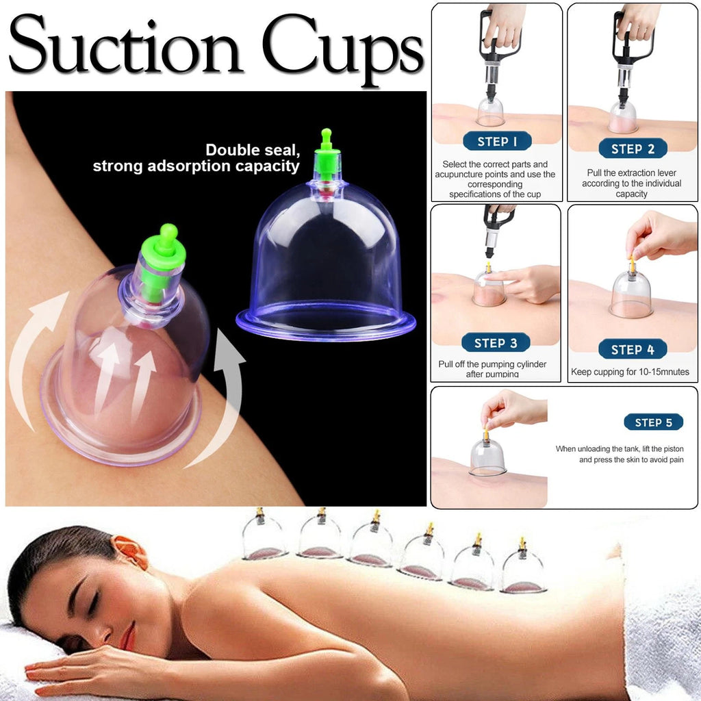 12PCS Cupping Vacuum Massage Cups Therapy Set Health Acupuncture Suction UK