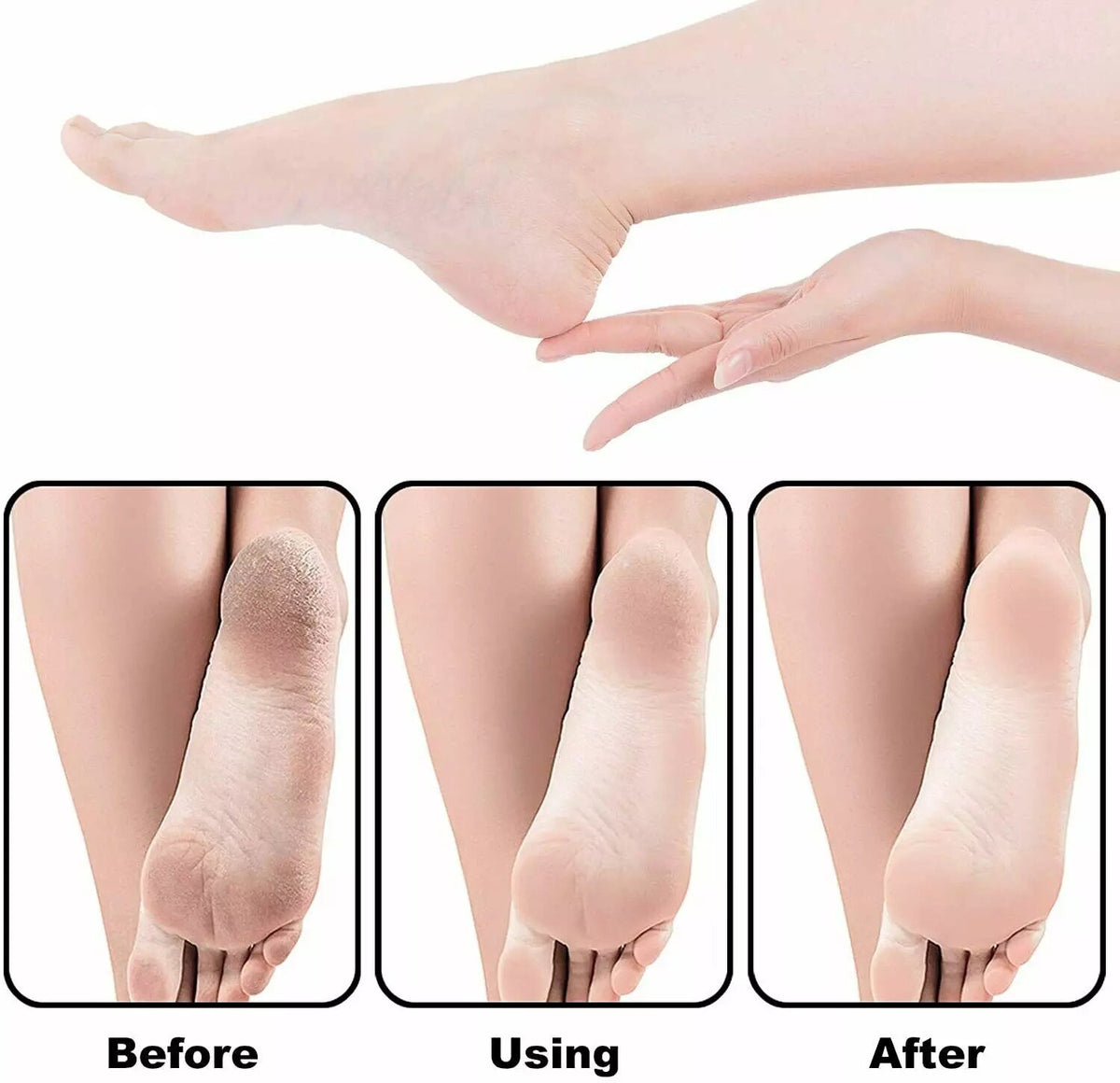 10x Foot File Replacement Pads Corns Callus Removal Pedicure File Refill Pad