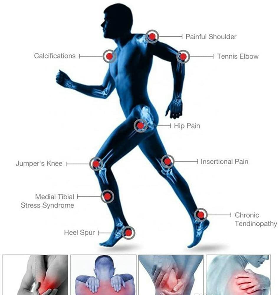 ESWT Focused Shockwave Therapy Machine Relieve Muscle Pain ED Treatment Handheld