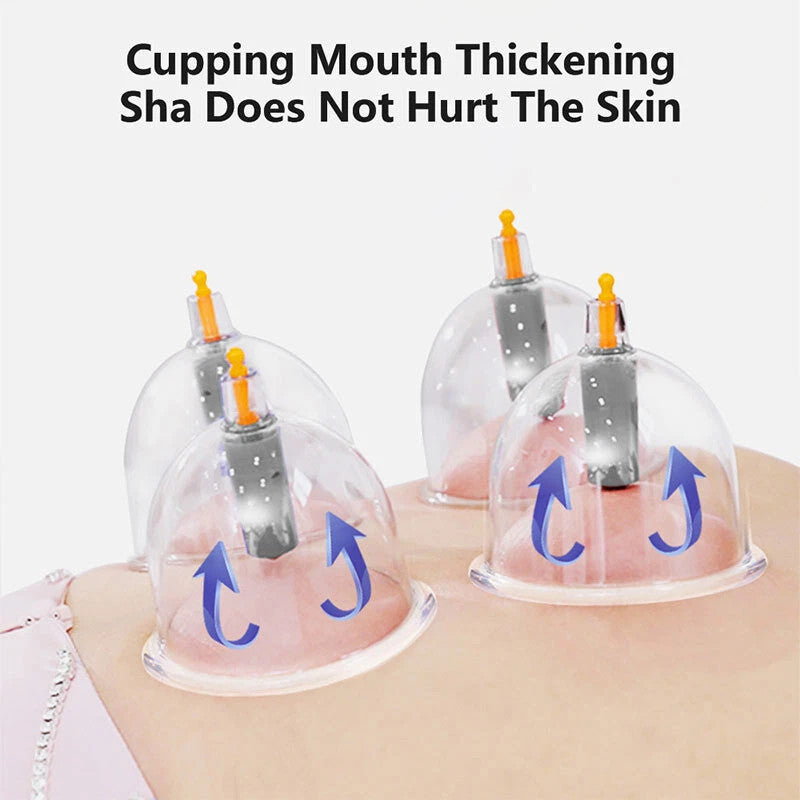 32PCS Cupping Vacuum Massage Cups Set Therapy Health Acupuncture Suction Magnet