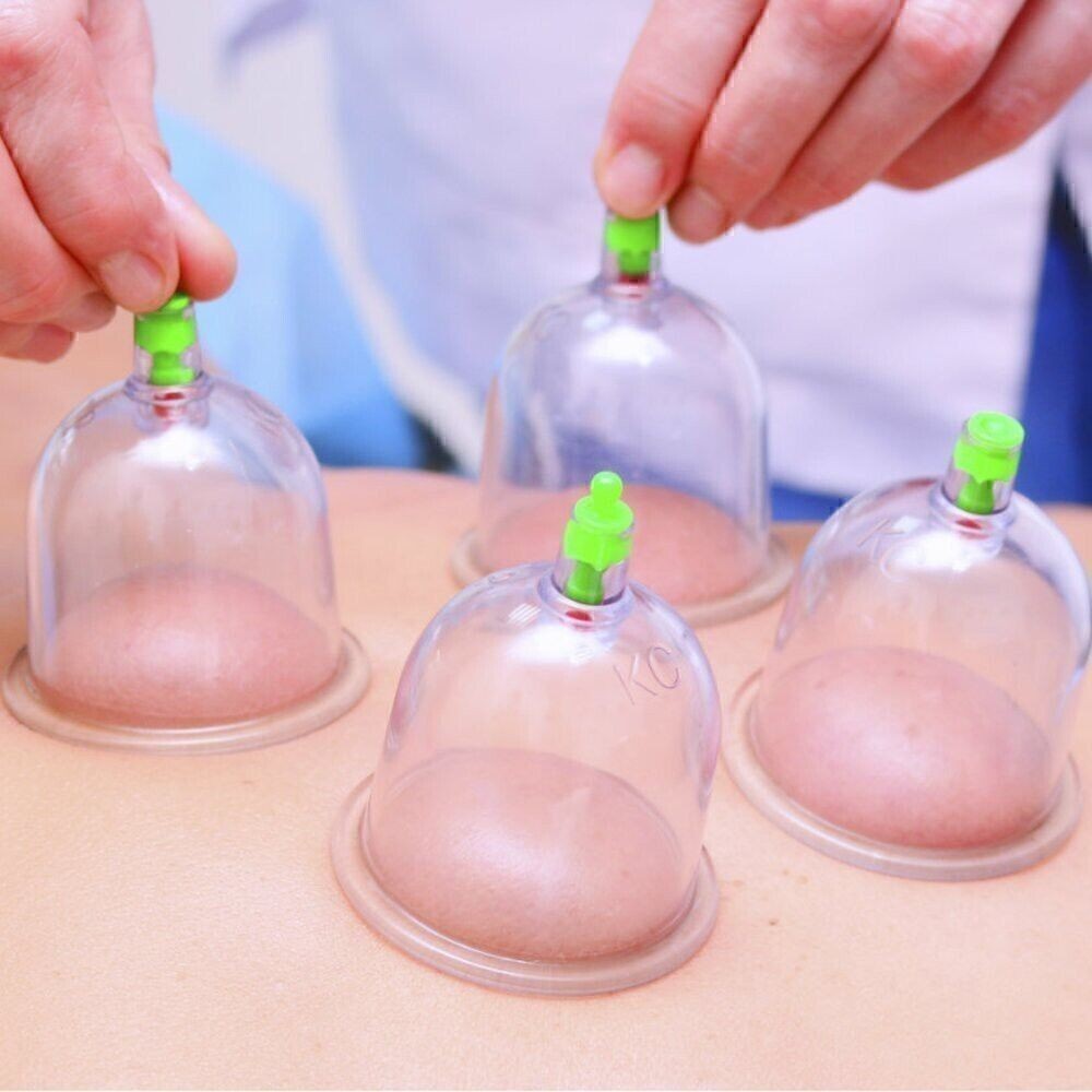 12PCS Vacuum Cupping Set Massage Therapy Cups Suction Health Acupuncture UK
