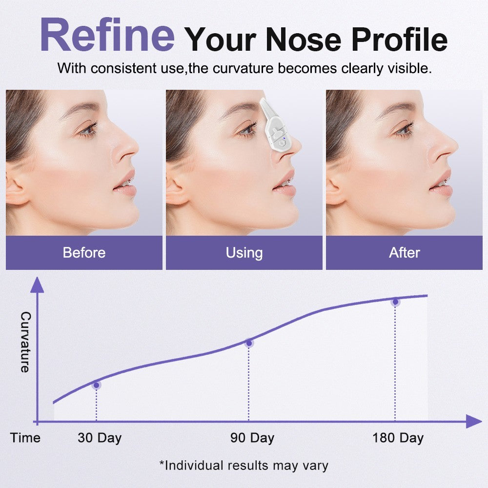 Easy-Use Electric E-M-S Nose Shaper: Patented Silicone Clip for Daily Nose Care
