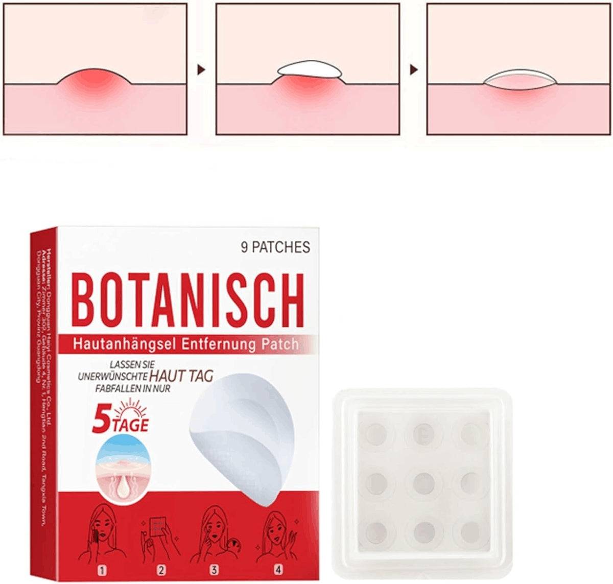 BOX MICRONEEDLE BOTANIC Skin Tag & Acne Patch 9 Pcs Skin Tag Remover Patches