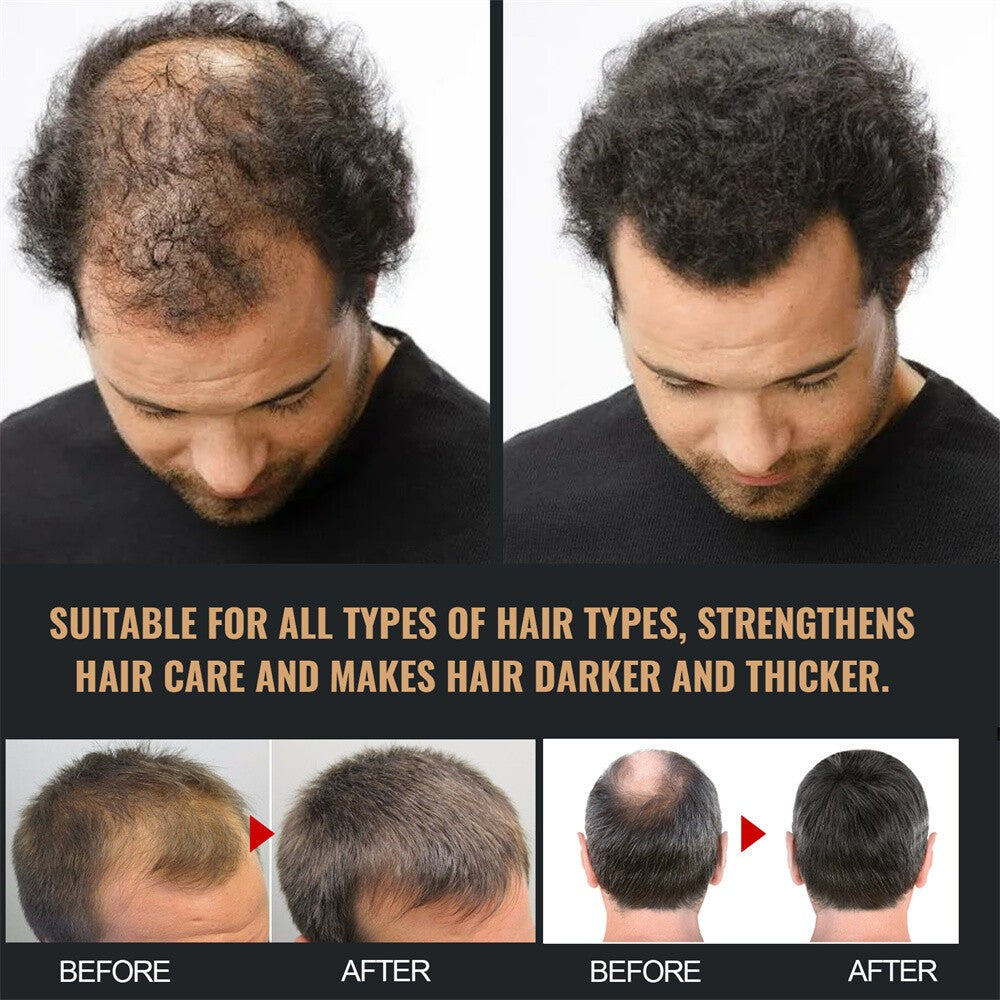 Spartan Shampoo, Spartan Root Activator Shampoo, Mane Root Activator for Hair~
