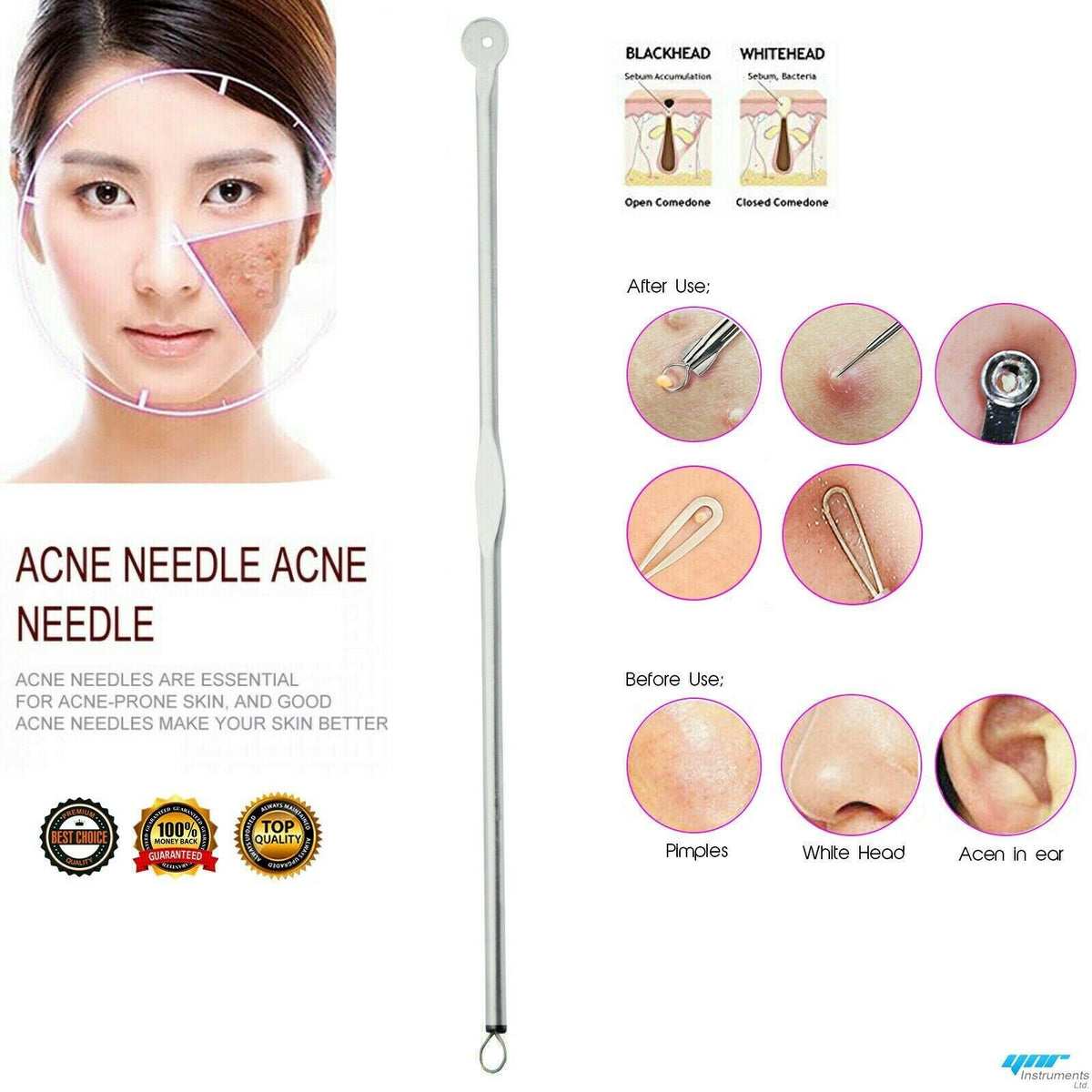 Whitehead & Blackhead Facial Acne Pimple Extractor Comedone Remover Small Tool