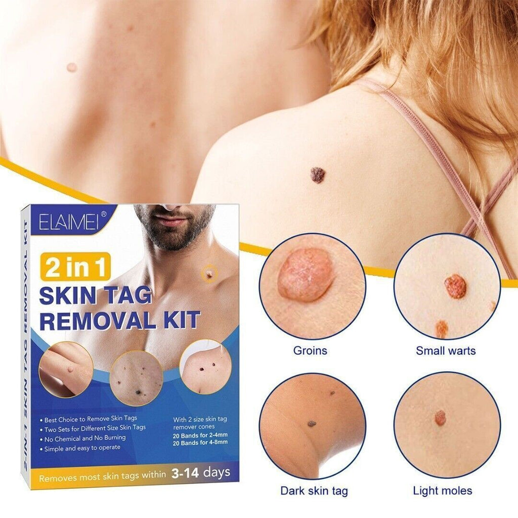 2in1 Wart Papilloma Skin Tag Remover Painless Remover Wart Remover Kit