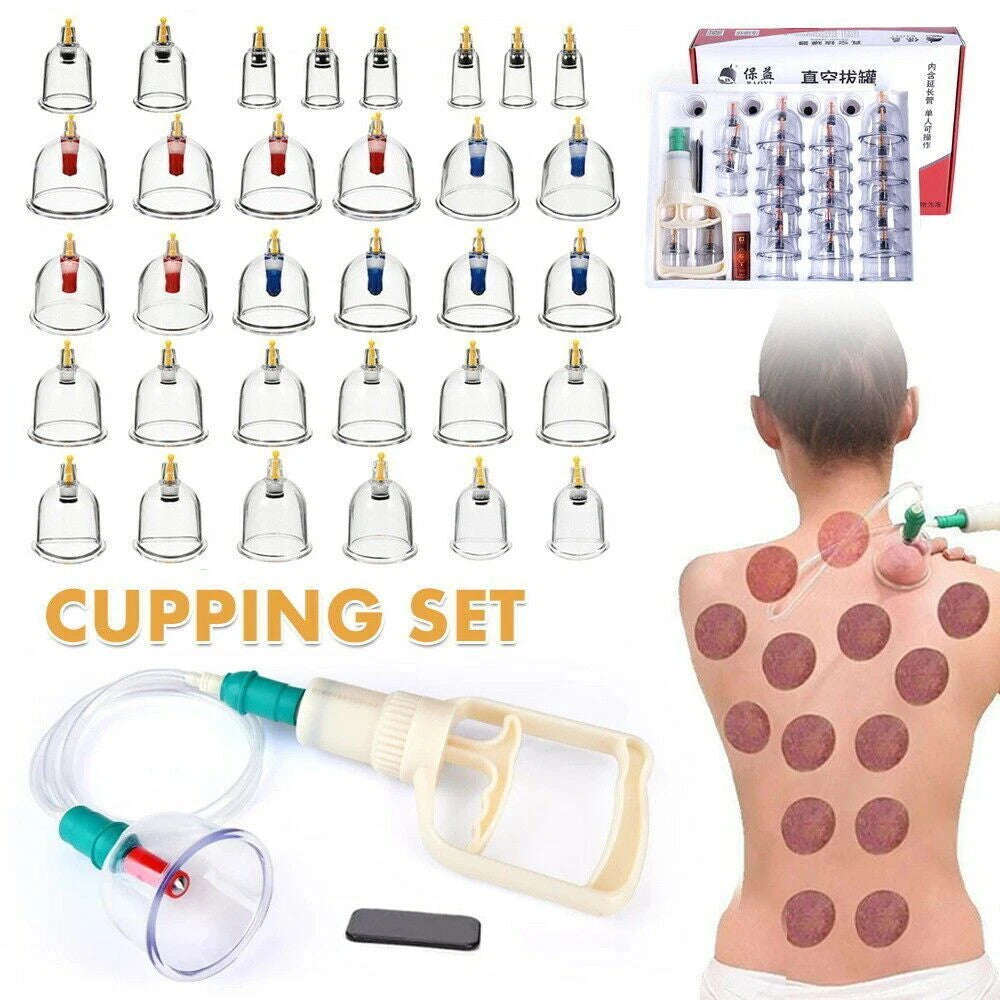 32PCS Cupping Vacuum Massage Cups Set Therapy Health Acupuncture Suction Magnet