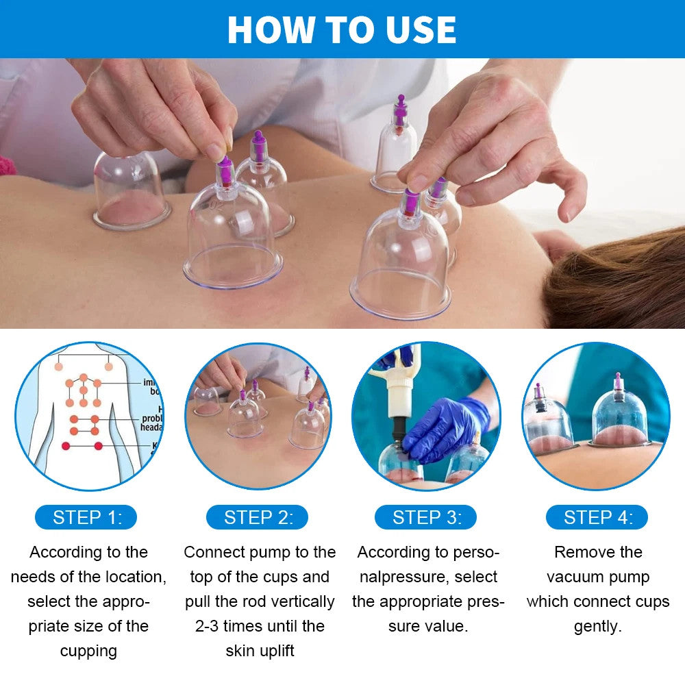 32PCS Cupping Vacuum Massage Cups Set Therapy Health Acupuncture Suction Magnet