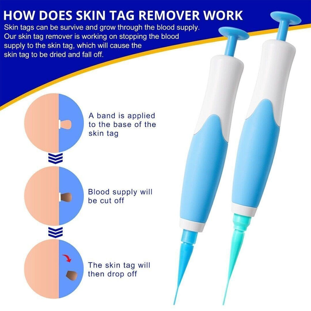 2in1 Wart Papilloma Skin Tag Remover Painless Remover Wart Remover Kit