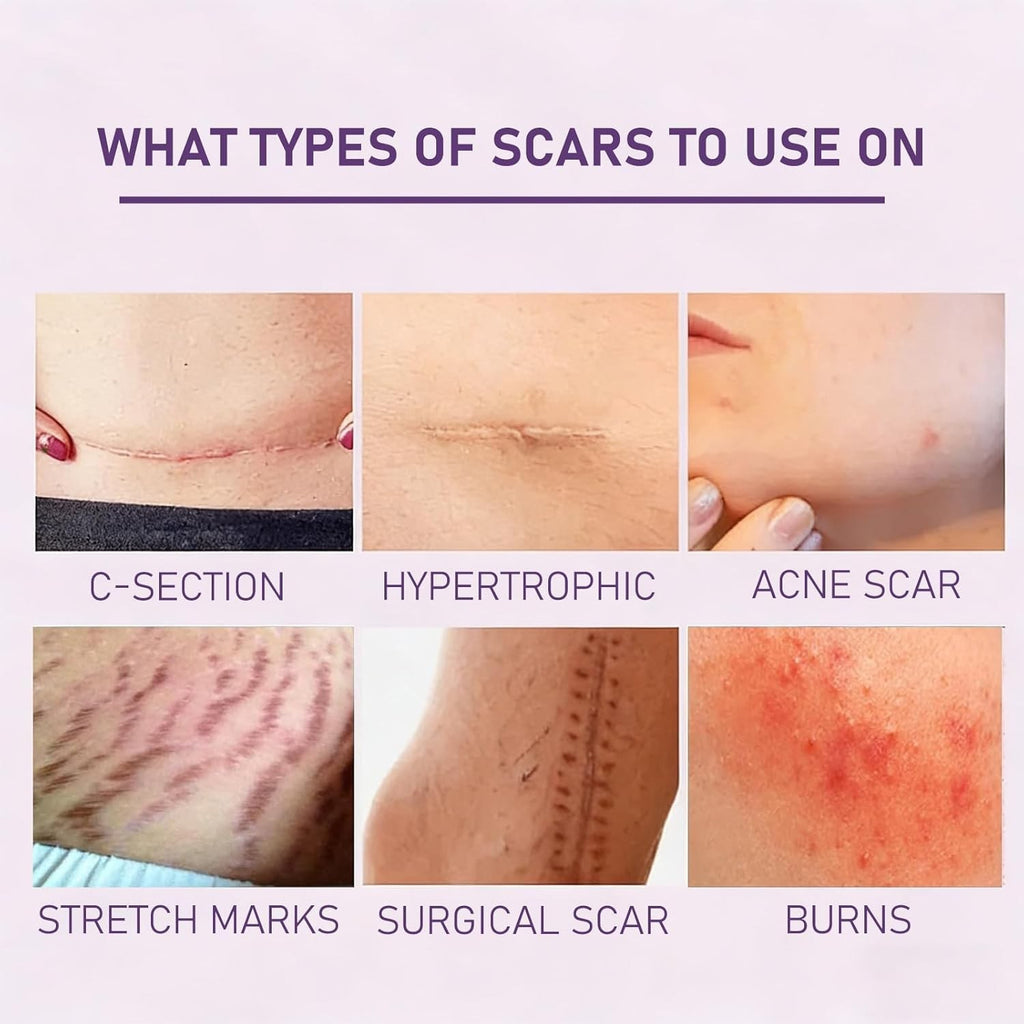 Scarlette Collagen Tape, Scarlette Collagen Sheets for Scars & Wrinkle, Silicone