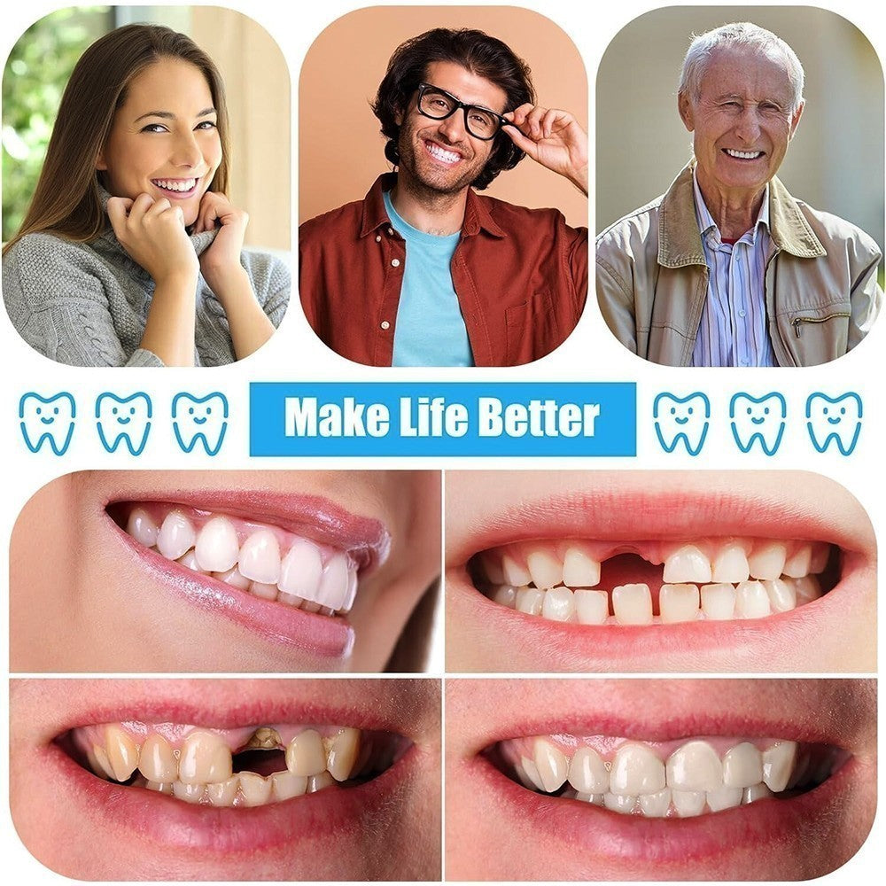 DIY Denture Kit Full Partial Fake Teeth Set, Home Repair for Missing Teeth