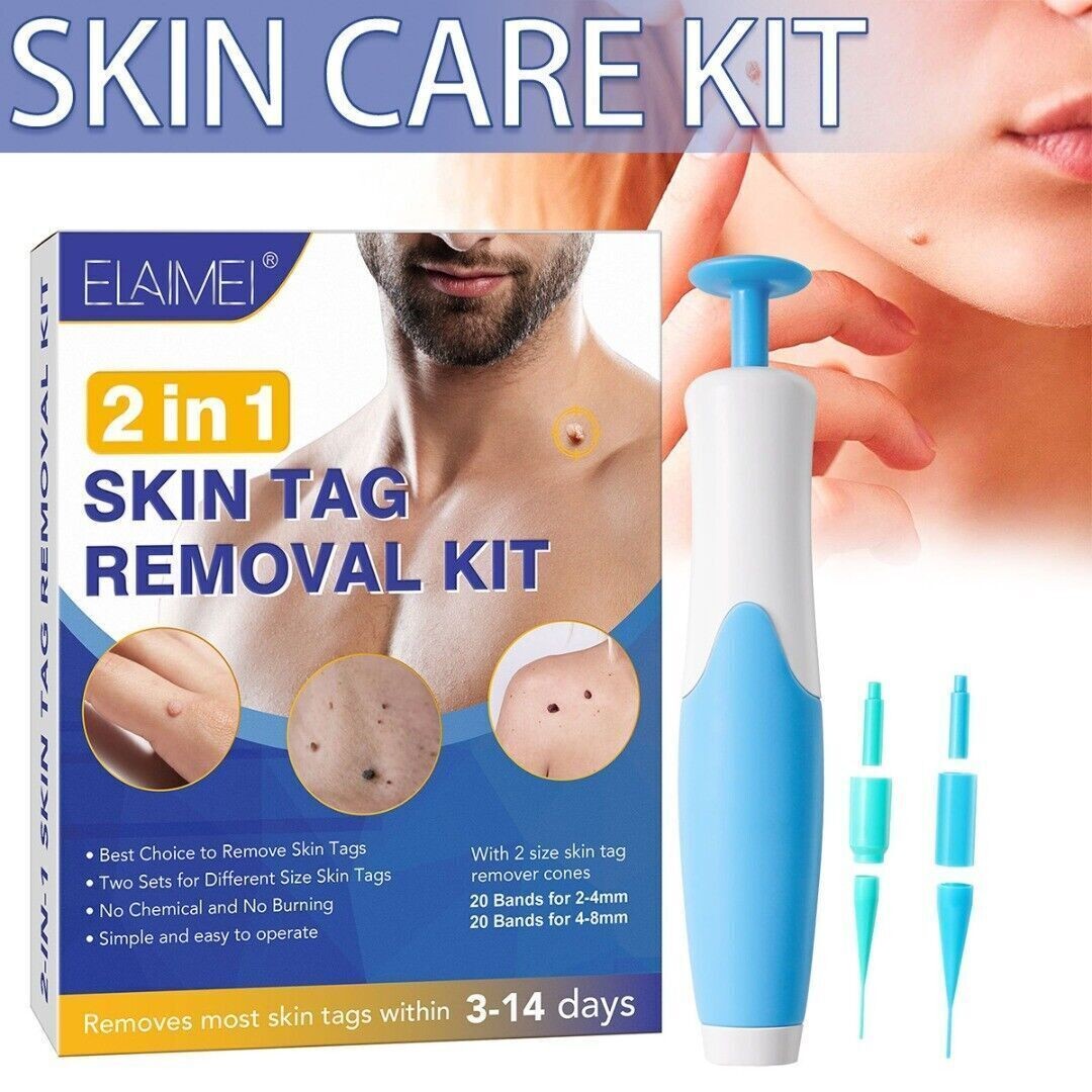 2in1 Wart Papilloma Skin Tag Remover Painless Remover Wart Remover Kit