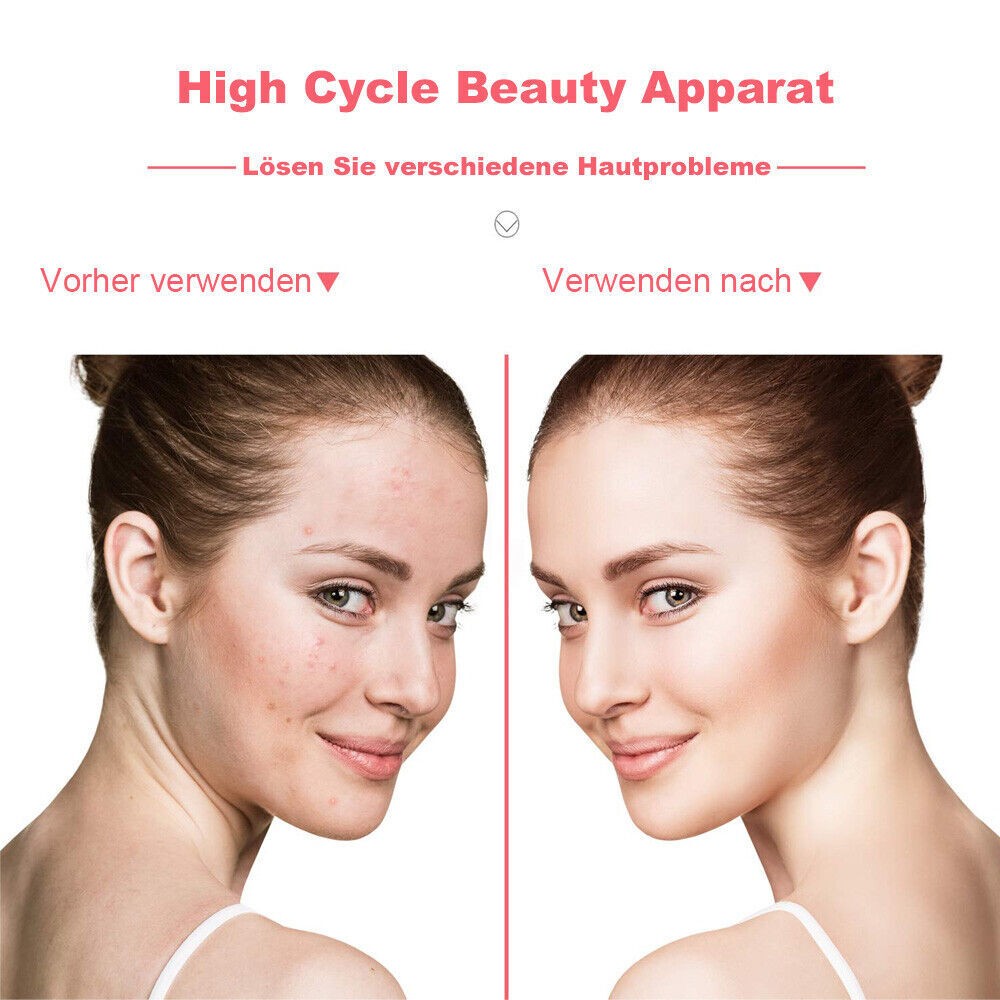 UK Portable High Frequency Electrotherapy Skin Therapy Wand Machine Acnes Remove