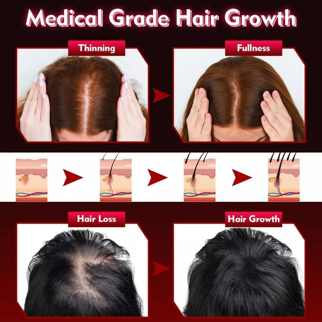 LED Red Light Therapy Hair Growth Cap Fast Regrowth Anti-Hair Loss Hat UK