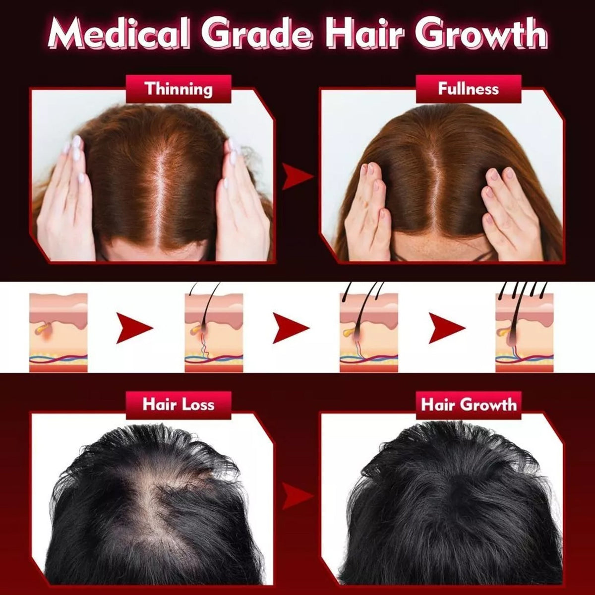 LED Red Light Therapy Hair Growth Cap Fast Regrowth Anti-Hair Loss Hat UK