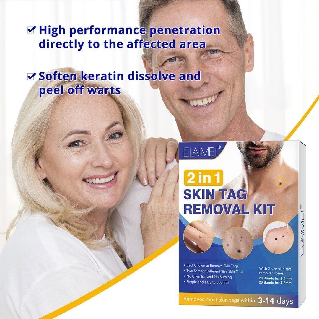 2in1 Wart Papilloma Skin Tag Remover Painless Remover Wart Remover Kit