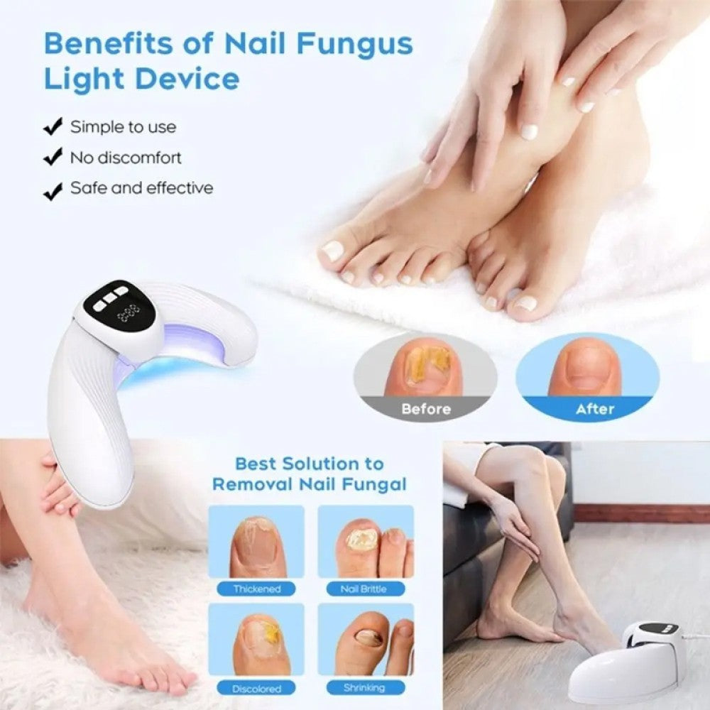 Nail Fungus Laser Device Light Therapy Onychomycosis Toes Treatment Anti Fungal