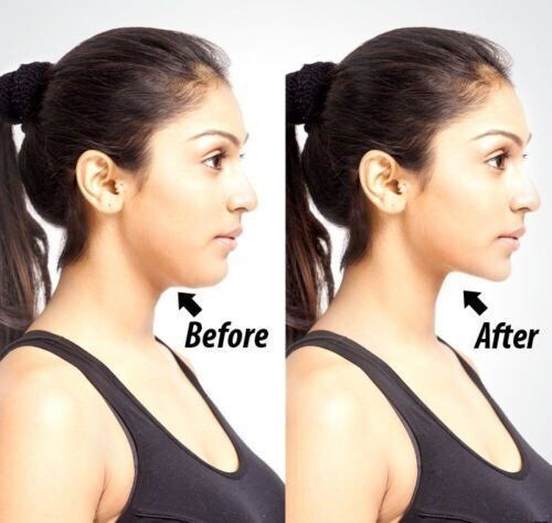 Chin & Neckline Slimmer Jaw Massager Reduces Double Chin Fat Lifts Face Exercise