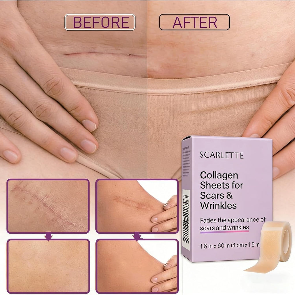 Scarlette Collagen Tape, Scarlette Collagen Sheets for Scars & Wrinkle, Silicone