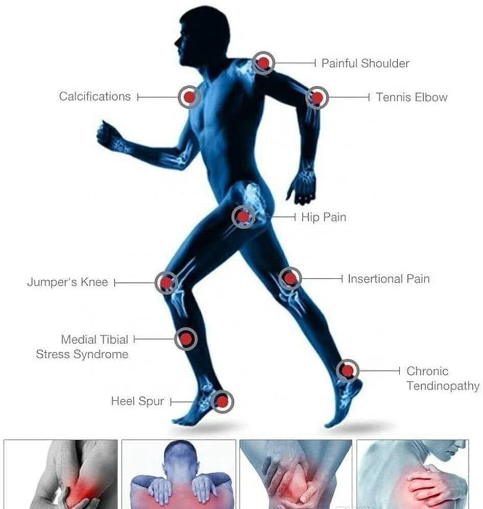 ED Shockwave Therapy Machine Effective Electromagnetic Extracorporeal Shock Wave