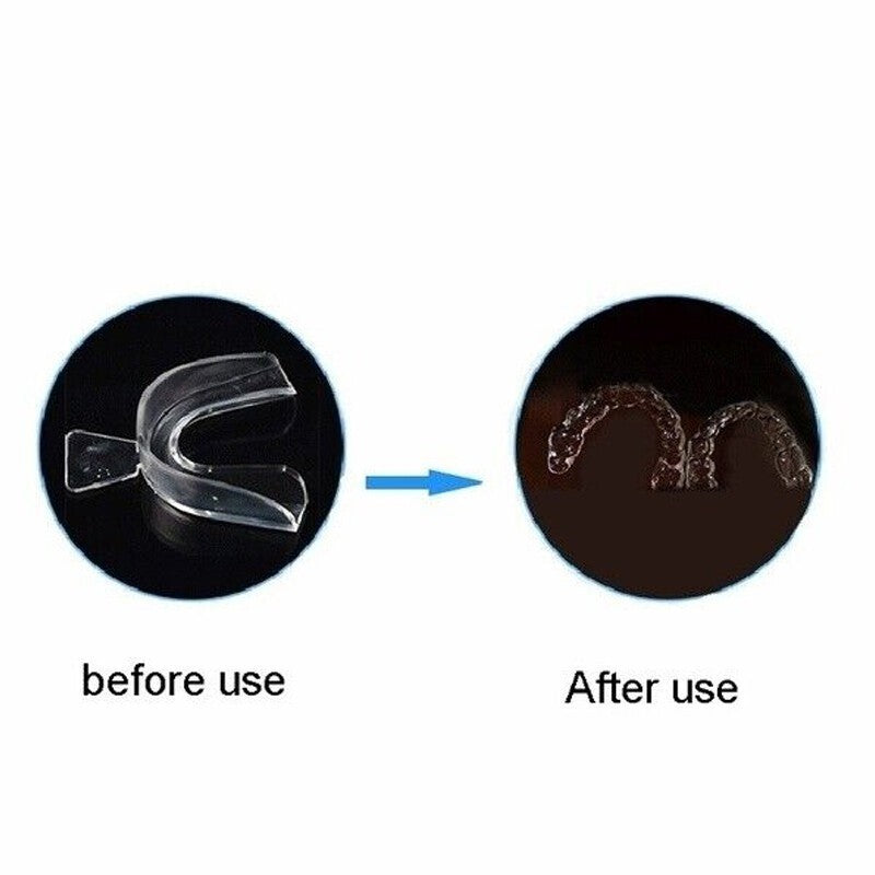 2/4PCS Sleeping Mouth Guard Stop Teeth Grinding Anti Snoring Bruxism Eliminates.