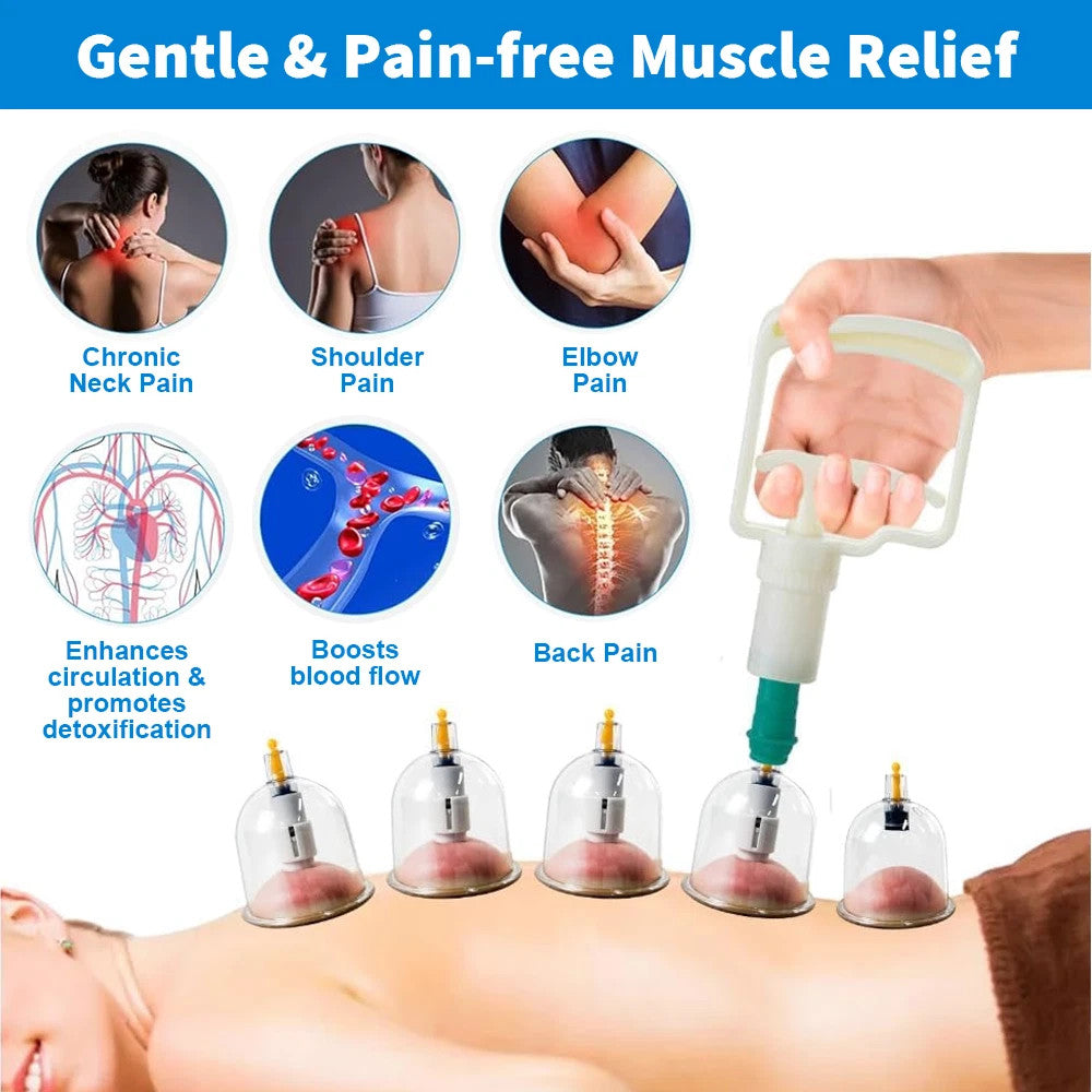 32PCS Cupping Vacuum Massage Cups Set Therapy Health Acupuncture Suction Magnet