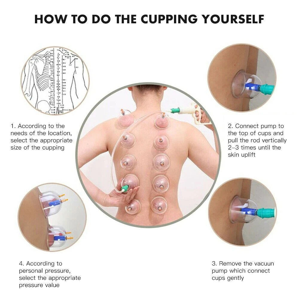 32PCS Cupping Vacuum Massage Cups Set Therapy Health Acupuncture Suction Magnet