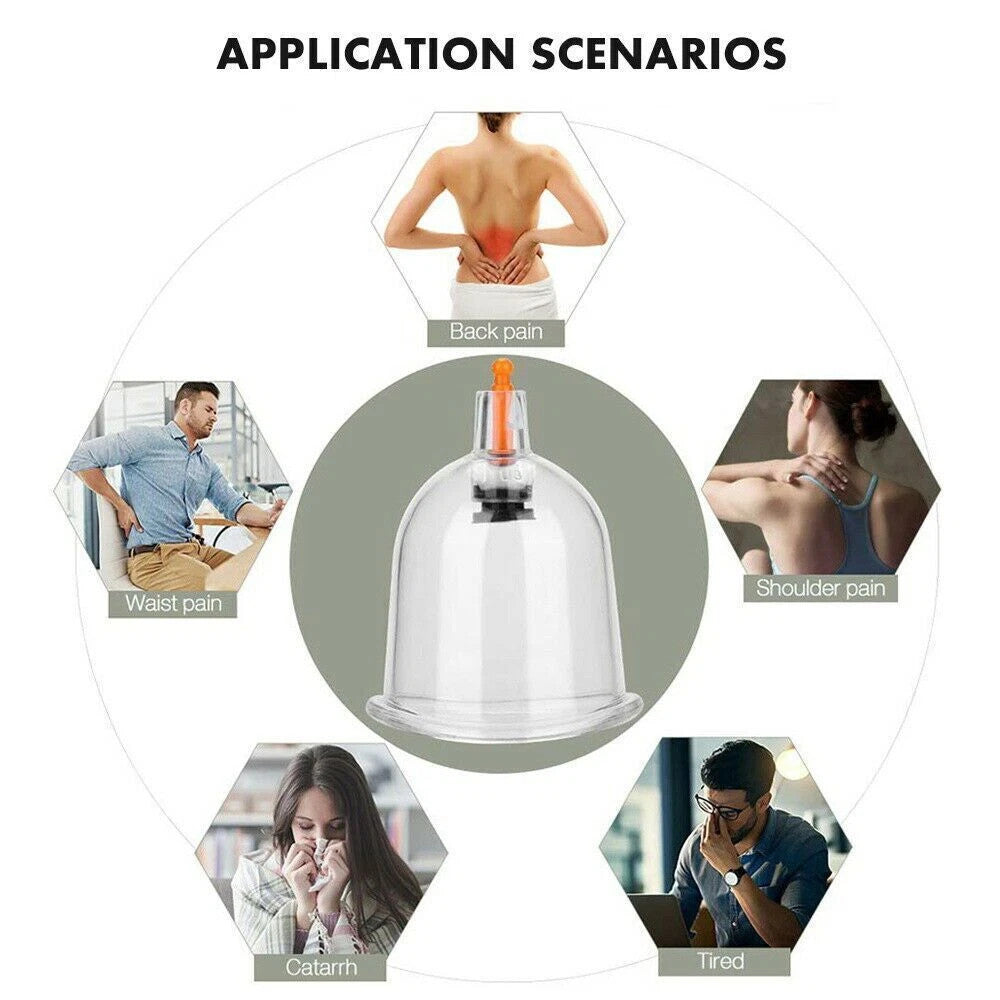 32PCS Cupping Vacuum Massage Cups Set Therapy Health Acupuncture Suction Magnet
