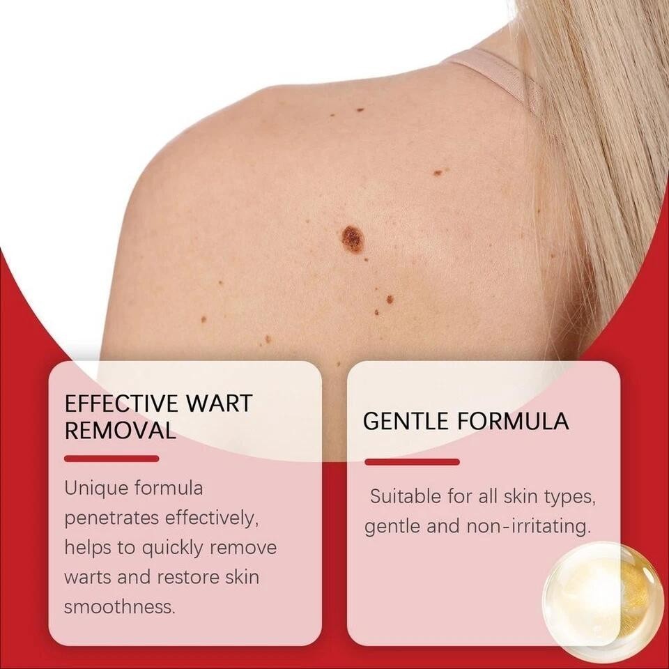 BOX MICRONEEDLE BOTANIC Skin Tag & Acne Patch 9 Pcs Skin Tag Remover Patches