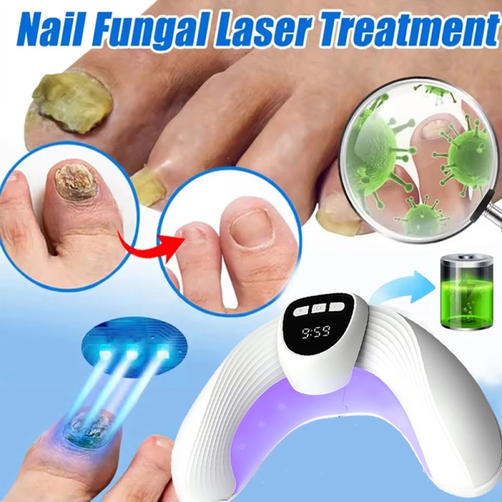 Nail Fungus Laser Device Light Therapy Onychomycosis Toes Treatment Anti Fungal