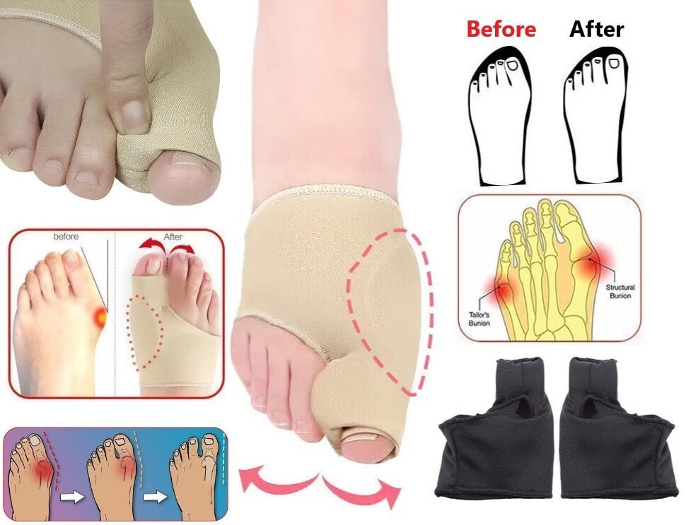 2pcs Big Toe Bunion Corrector Hallux Valgus Corrector Straightener Separators UK